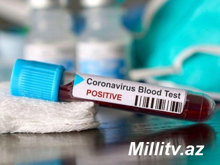 Azərbaycanda daha 257 nəfərdə koronavirus aşkarlandı - 3 nəfər vəfat etdi, 202 pasiyent sağaldı