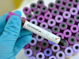 Azərbaycanda bir sutkada 347 nəfər koronavirusa yoluxdu - 6 ölü