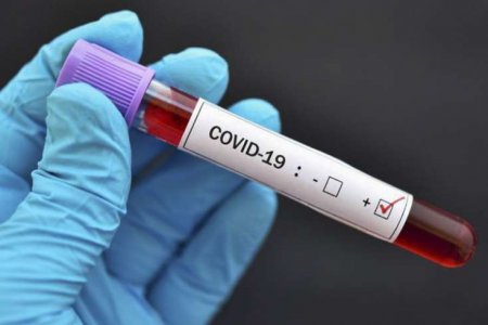 İranda son sutkada 109 nəfər koronavirusdan öldü