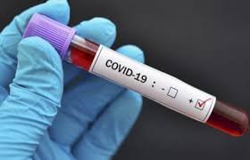 Koronavirusa yoluxanların sayı 144-ə düşdü - 3 ölü